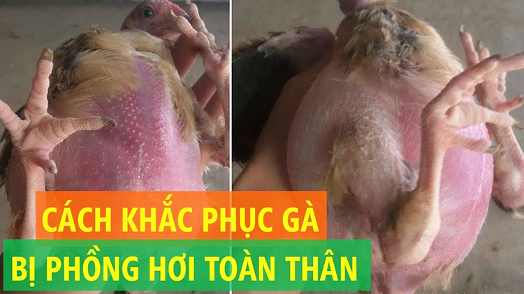 Cách Trị Mụn Nước Dưới Da Gà [DỄ DÀNG] và [HOÀN HẢO]