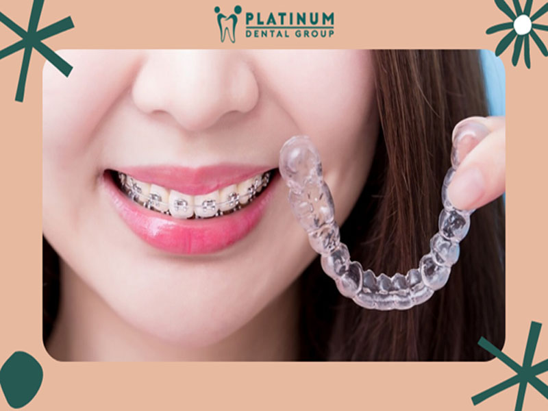 Hãy chọn Nha khoa Platinum cho nụ cười của bạn