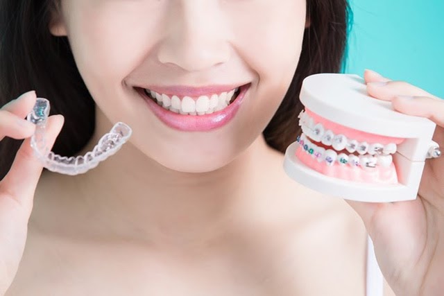 Niềng răng trong suốt sẽ có chi phí cao hơn niềng răng mắc cài truyền thống